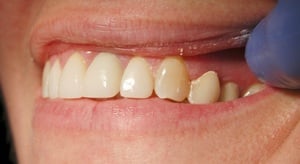 round valley dentist