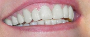 round valley dentistry