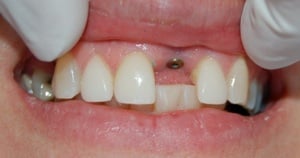 round valley dentist