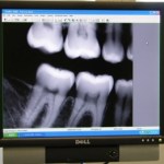 dentist round valley new jersey